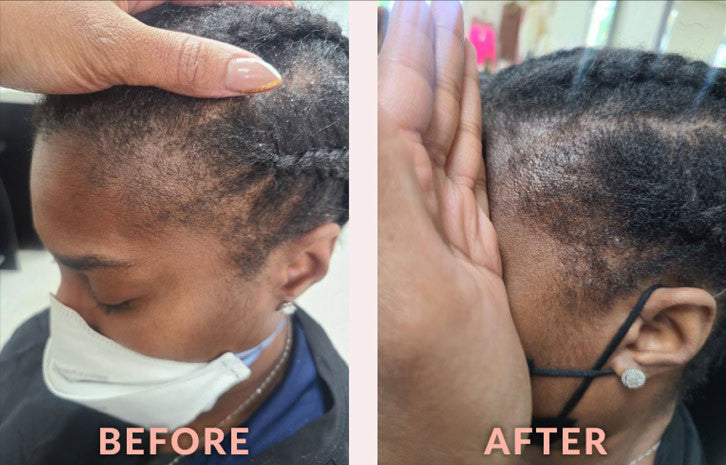 Scalp Care Edge & Temple Strengthening Oil